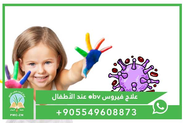 علاج فيروس ebv عند الأطفال