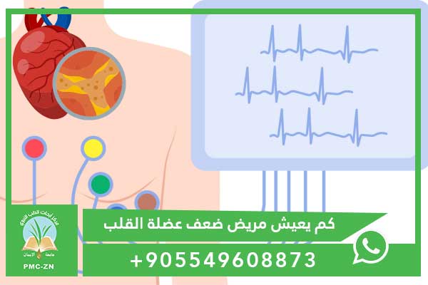 كم يعيش مريض ضعف عضلة القلب