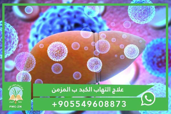 علاج التهاب الكبد ب المزمن