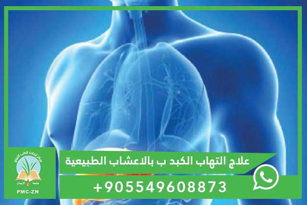 علاج التهاب الكبد ب بالاعشاب الطبيعية – العلاج الجديد