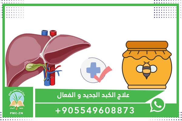 علاج الكبد بالعسل