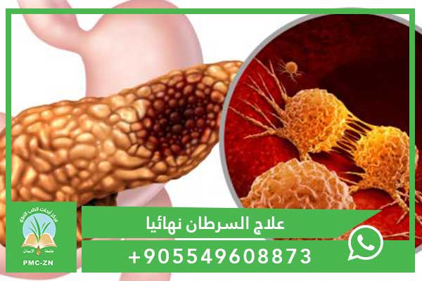 أعراض سرطان البنكرياس في المرحلة الأخيرة