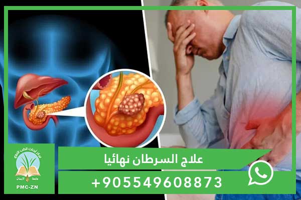 كيفية وفاة مريض سرطان البنكرياس